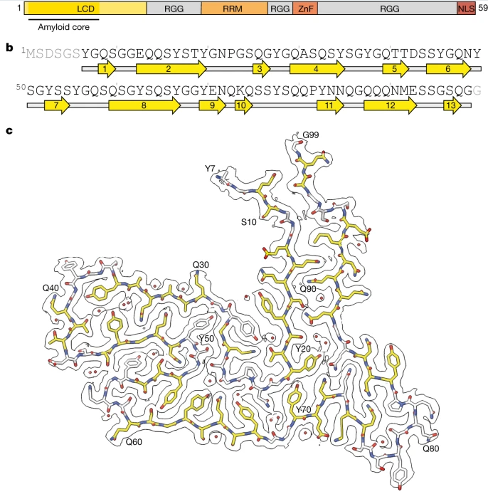 Nature:科學家識別出與人類額顳葉癡呆癥發生相關的新型蛋白質 Nature:科學家識別出與人類額顳葉癡呆癥發生相關的新型蛋白質